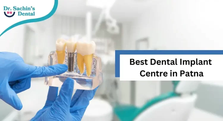 Best Dental Implant Centre in Patna