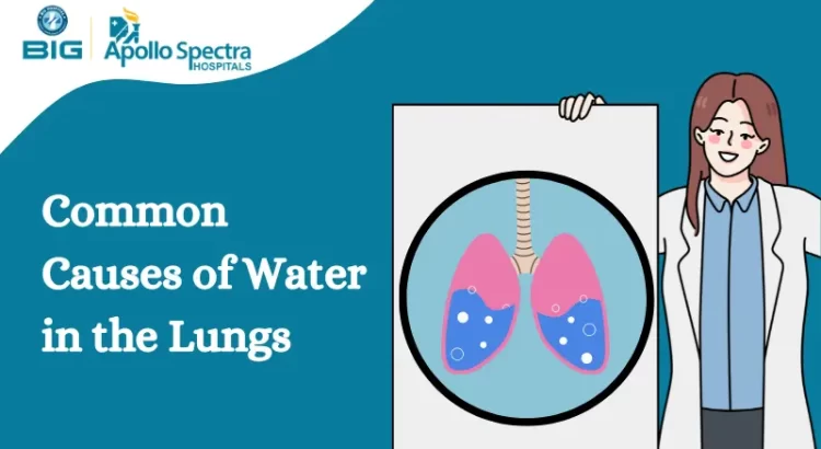 common causes of water in the lungs