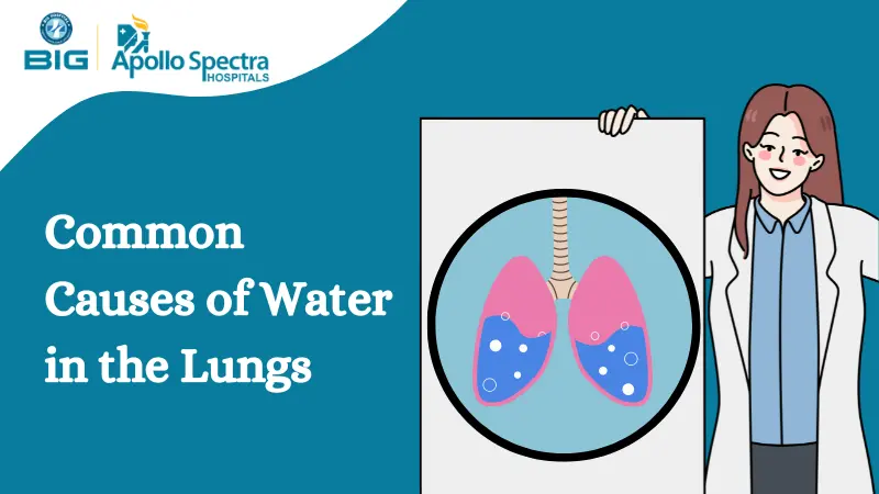 What are the Common Causes of Water Buildup in the Lungs?