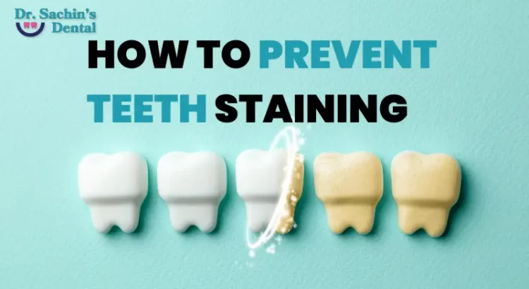 How to Prevent Teeth Staining