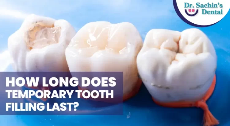 How Long Does Temporary Tooth Filling Last