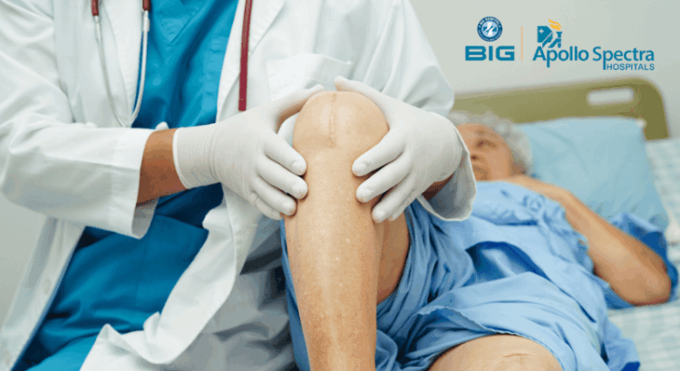 Life Span of Knee Replacement In Patna