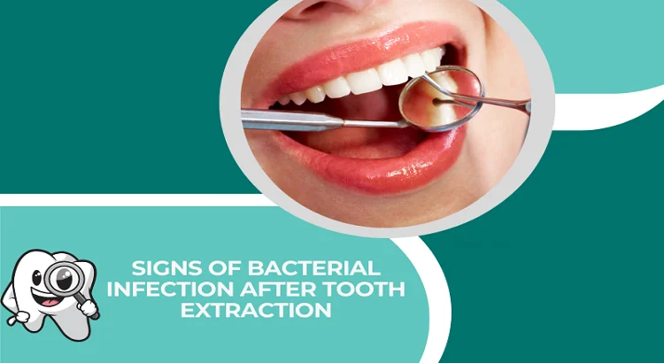 Signs of bacterial infection after tooth extraction