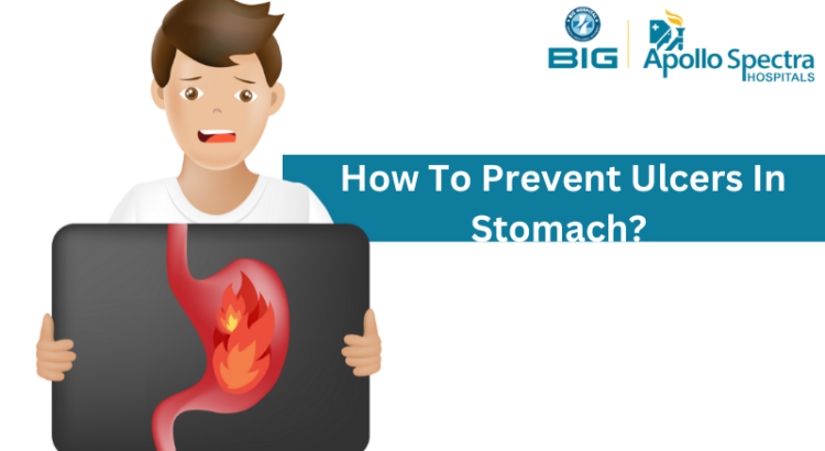 How To Prevent Ulcers In Stomach