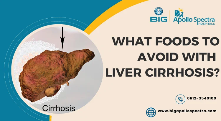 What foods to avoid with liver cirrhosis