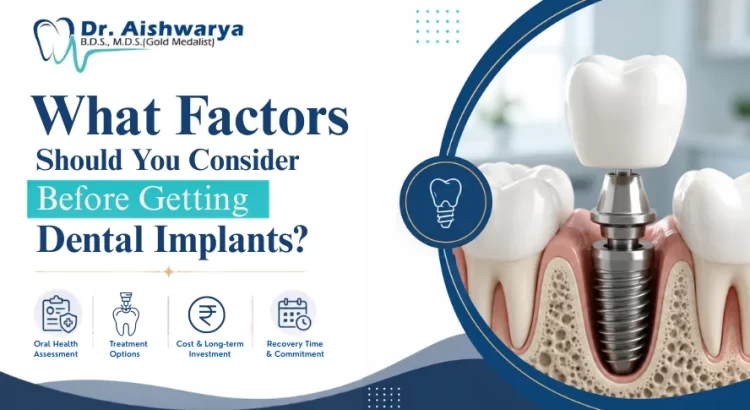 Factors to Consider Before Getting Dental Implants