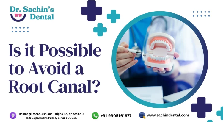 Is it Possible to Avoid a Root Canal