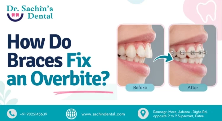 How Do Braces Fix an Overbite