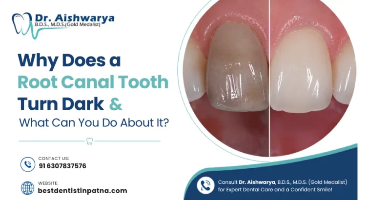 Why does a root canal tooth turns dark