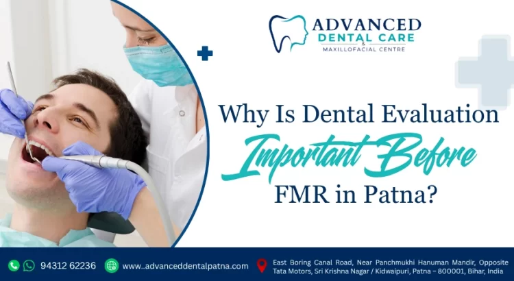 Why Is Dental Evaluation Important Before Full Mouth Rehabilitation in Patna